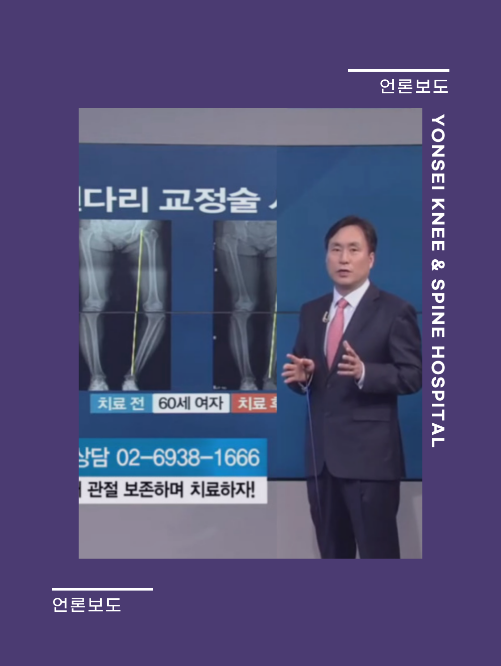 SBSCNBC < 건강플러스 > 무릎통증 내 관절 보존하며 치료하자! - 제진호 병원장 출연