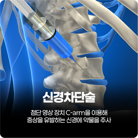 신경차단술